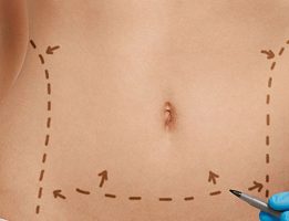 tüm-vucüt-şekillendirme