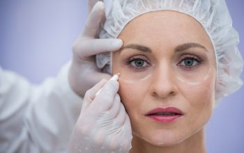 göz kapağı estetiği