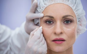 göz kapağı estetiği