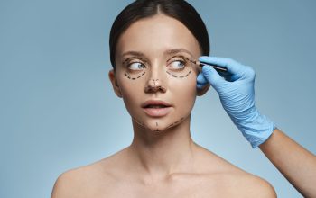 göz kapağı estetiği (2)